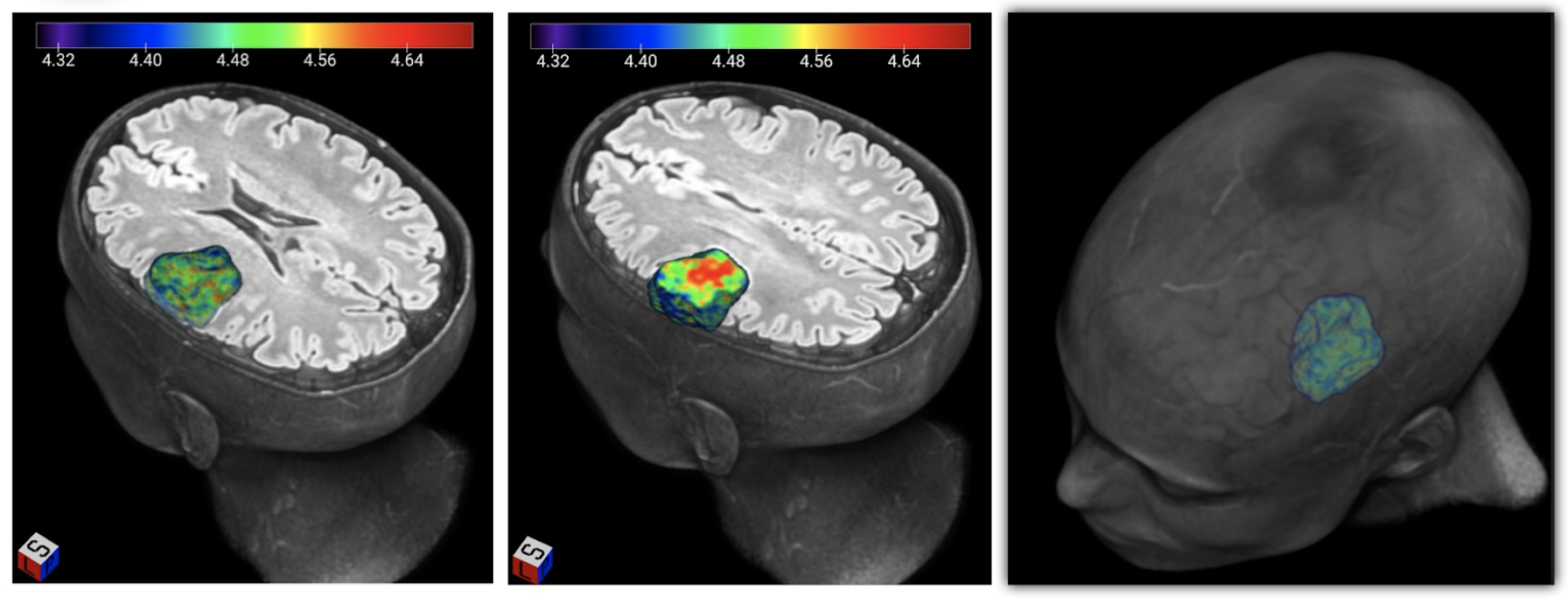 3D Radiomics Map