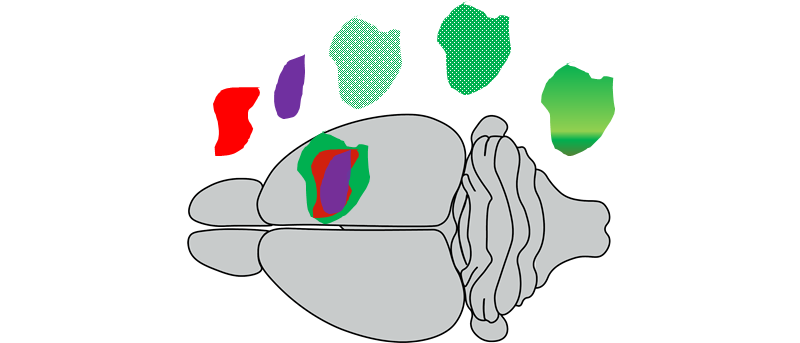 Scientists develop a novel noninvasive MRI methodology that may allow unprecedented level of stroke lesion analysis 