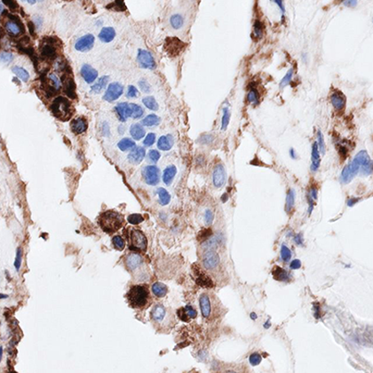 Against-Cancer-And-Infection Consortium