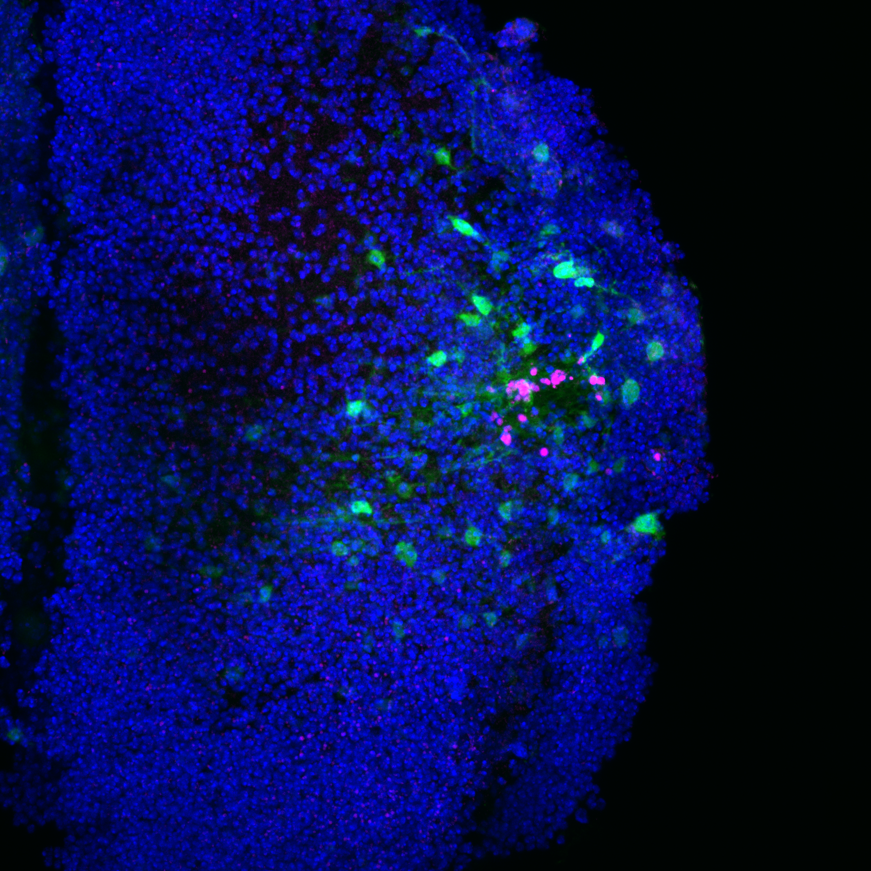 Controlled “Oxidative Spark”: A Surprising Ally in Brain Repair