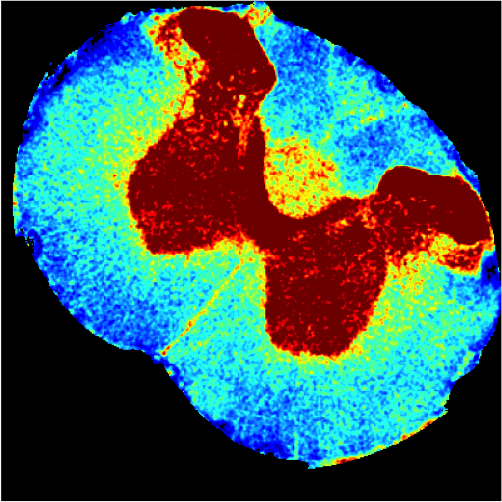 1.8M Euros awarded to Champalimaud Foundation researcher to develop pioneering imaging techniques