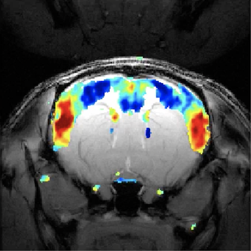 Study suggests the brain works like a resonance chamber