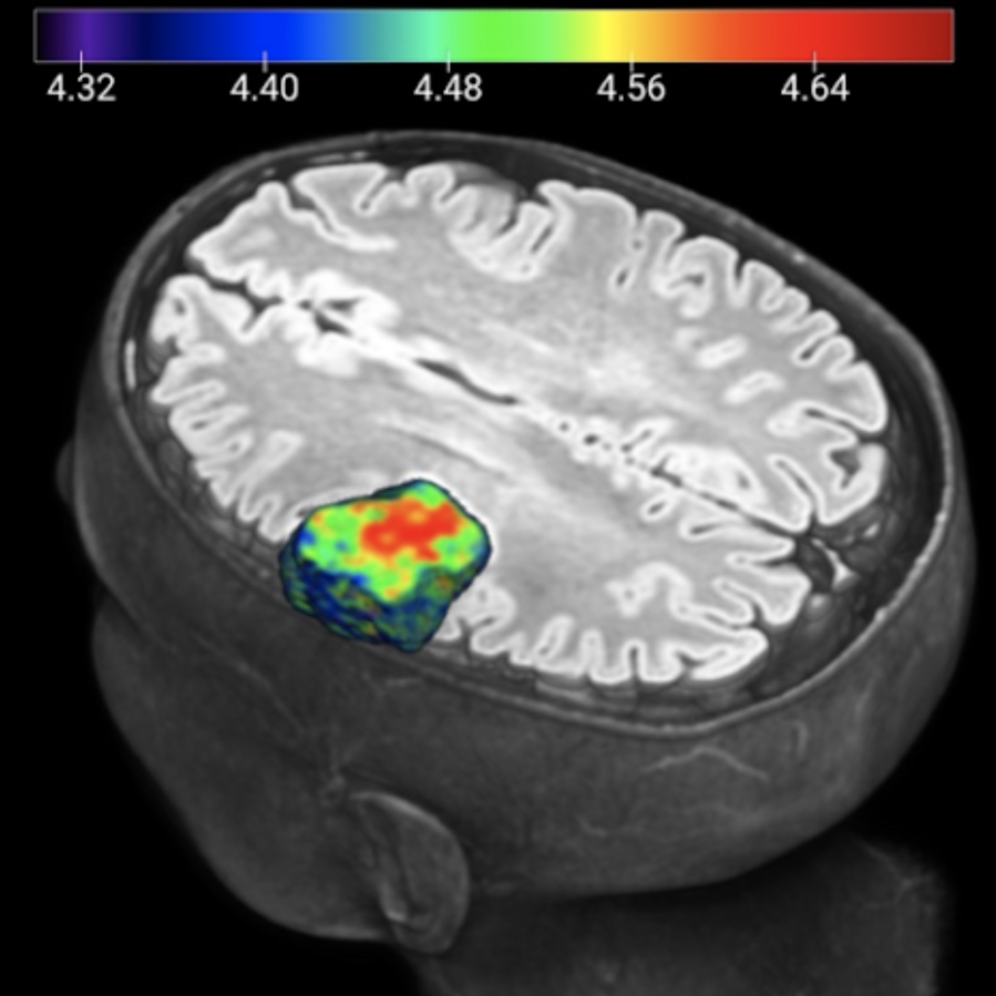 Artificial intelligence could extract a wealth of quantitative data from medical images for the benefit of cancer patients