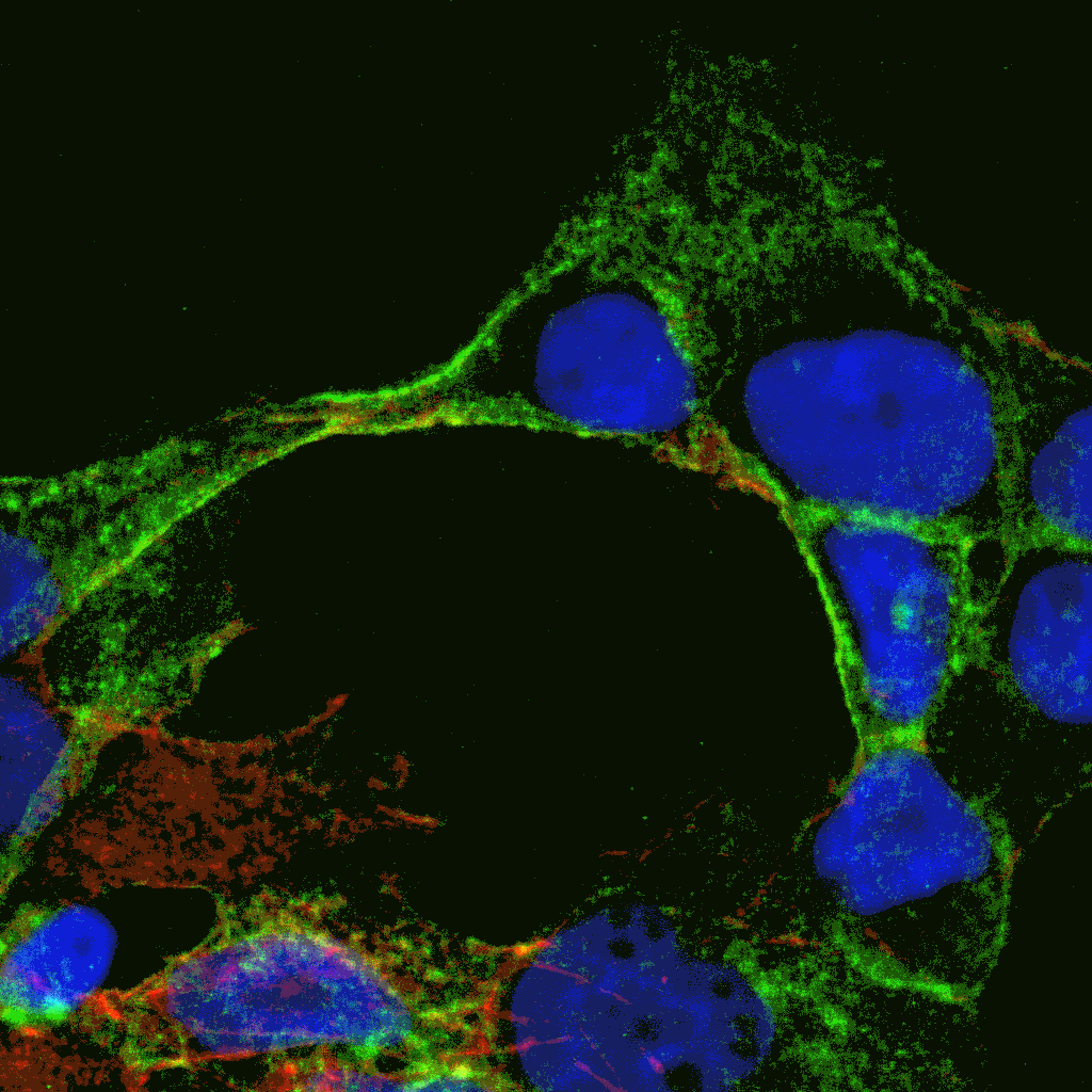 A new maestro identified in gastric cancer cell communication