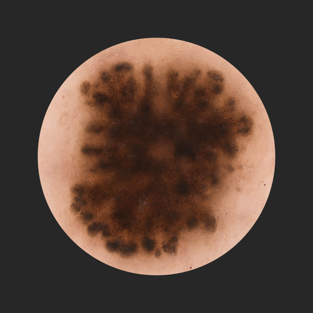  What am I looking at? A Skin-deep Secret