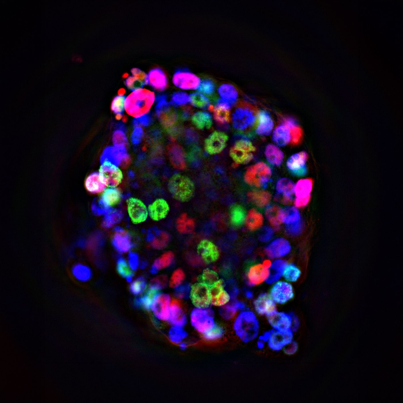 organoid