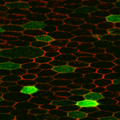 Ocular Low-Cost Gene Therapy