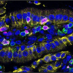 Tissue Immunity