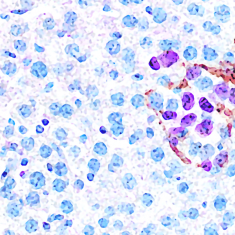 Cancer Dormancy & Immunity