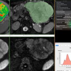 Computational Clinical Imaging Group