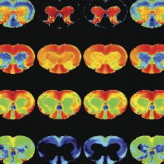 Preclinical MRI